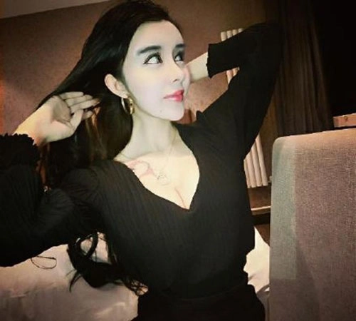 Cô gái 15 tuổi mặt cứng đờ vì thẩm mỹ quá đà - 3