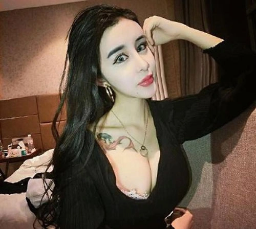 Cô gái 15 tuổi mặt cứng đờ vì thẩm mỹ quá đà - 4