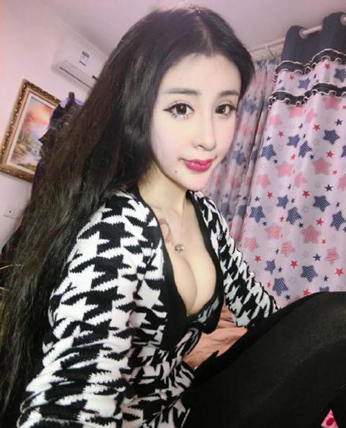 Cô gái 15 tuổi mặt cứng đờ vì thẩm mỹ quá đà - 5