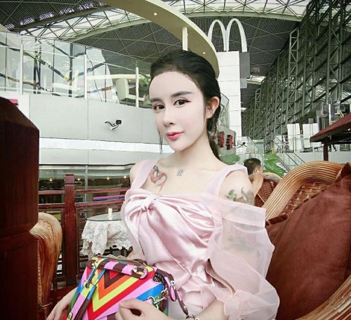 Cô gái 15 tuổi mặt cứng đờ vì thẩm mỹ quá đà - 9