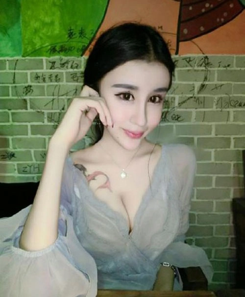 Cô gái 15 tuổi mặt cứng đờ vì thẩm mỹ quá đà - 12
