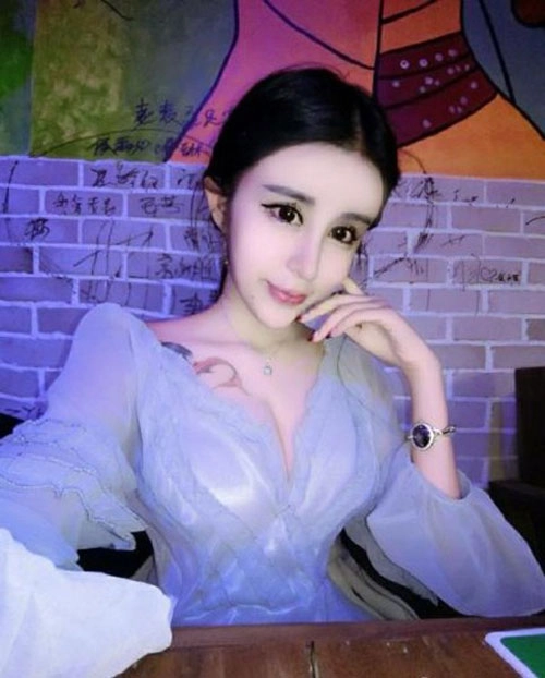 Cô gái 15 tuổi mặt cứng đờ vì thẩm mỹ quá đà - 14