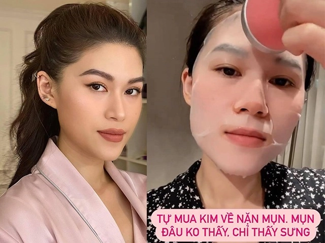 Cô giáo dạy catwalk cho đỗ thị hà gặp nạn làn da mong mọi người đừng xa lánh - 9