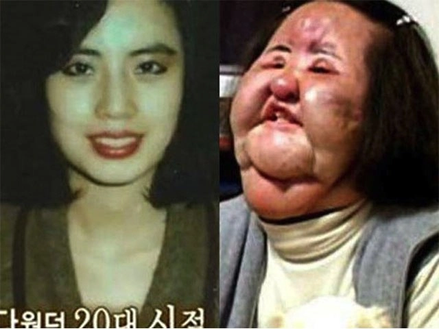 Đổi đời sau dao kéo gái nhật bị chê giống khỉ giờ thu tiền tỷ nhờ kinh doanh nhan sắc - 7