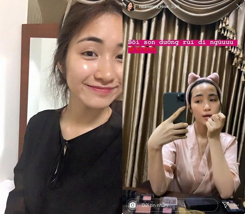 Một phút lầm lỡ bị mụn hành hòa minzy thất thế ngôi vương mặt mộc không tì vết - 3