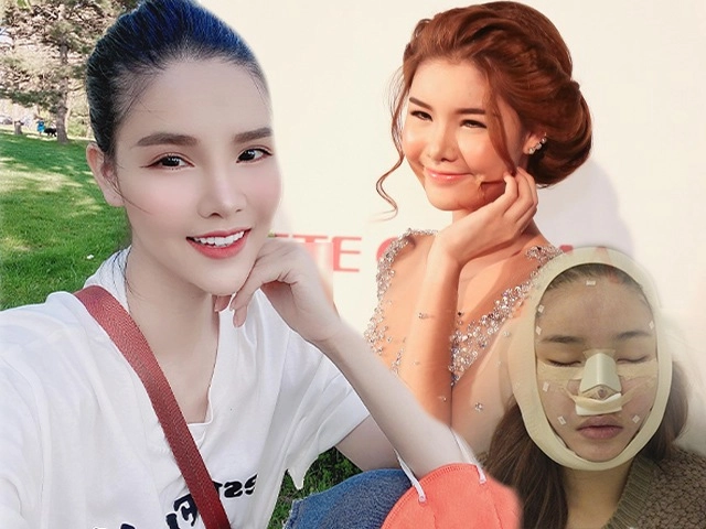 Tại sao gương mặt thường phù lên sau pttm có nguy hiểm không - 22