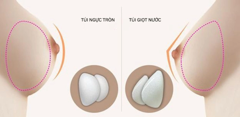 Vòng một nhân tạo đẹp nhất làng sắc đẹp việt thuộc về nhân vật này - 18