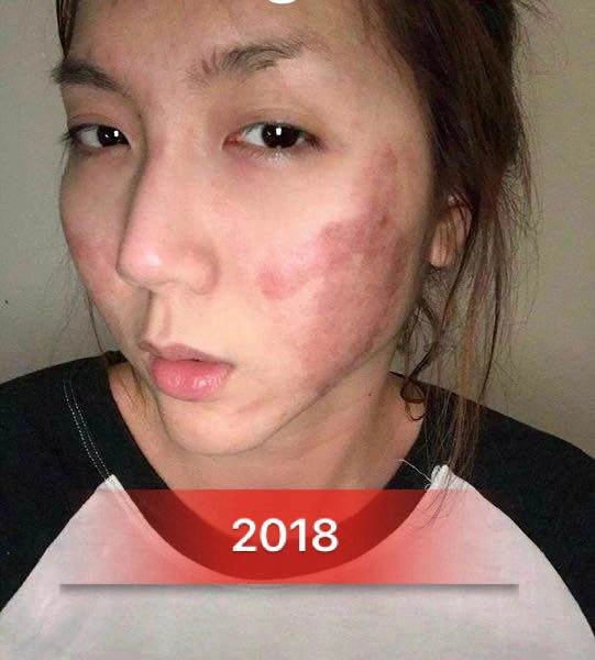 Yên ắng hậu ly hôn ngọc quyên bất ngờ đăng ảnh với gương mặt biến dạng nhận không ra - 1