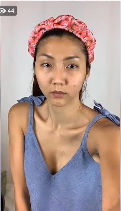 Yên ắng hậu ly hôn ngọc quyên bất ngờ đăng ảnh với gương mặt biến dạng nhận không ra - 2