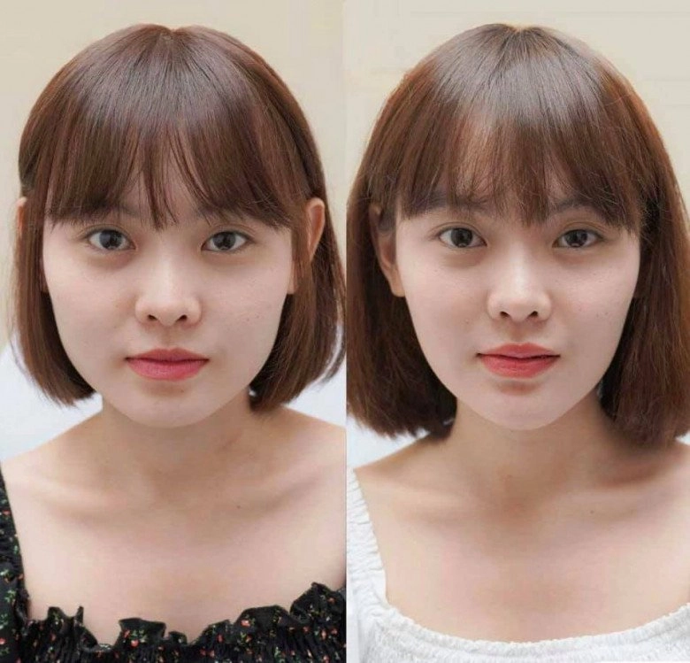 Yên ắng hậu ly hôn ngọc quyên bất ngờ đăng ảnh với gương mặt biến dạng nhận không ra - 12