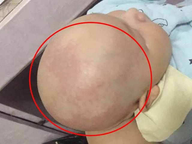 90 mẹ việt sẽ dừng ngay việc cạo trọc đầu con cho mát vào mùa hè vì nguy hiểm này - 9