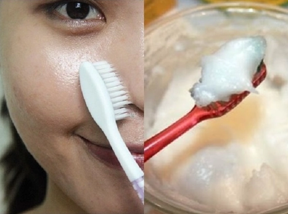 Cách trị mụn đầu đen tại nhà an toàn và hiệu quả - 2