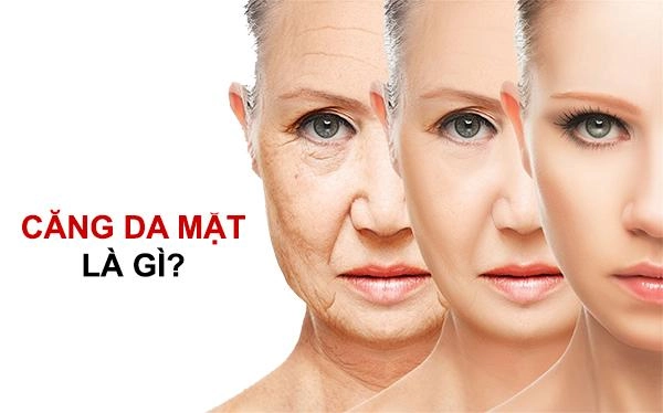 Căng da mặt và những điều cần biết để tránh hiểm họa khôn lường - 1