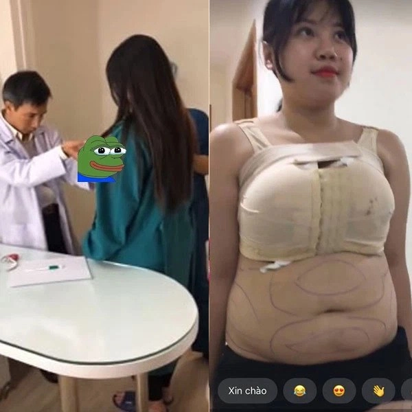 Hotgirl hải dương lận đận sửa sang hút 3 lít mỡ ngực vẫn chưa thon mũi lệch sửa lần 2 - 4