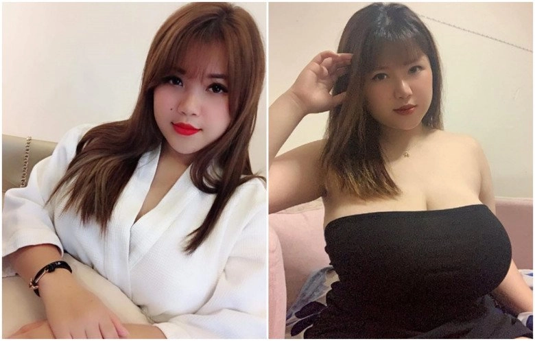 Hotgirl hải dương lận đận sửa sang hút 3 lít mỡ ngực vẫn chưa thon mũi lệch sửa lần 2 - 5