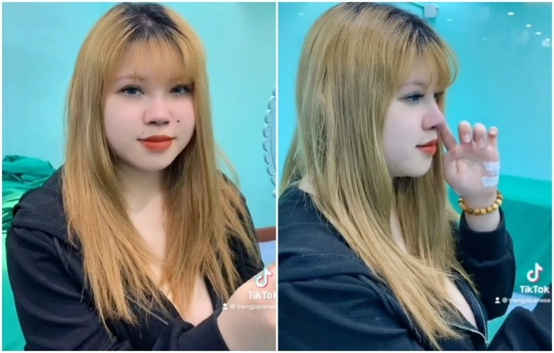 Hotgirl hải dương lận đận sửa sang hút 3 lít mỡ ngực vẫn chưa thon mũi lệch sửa lần 2 - 7