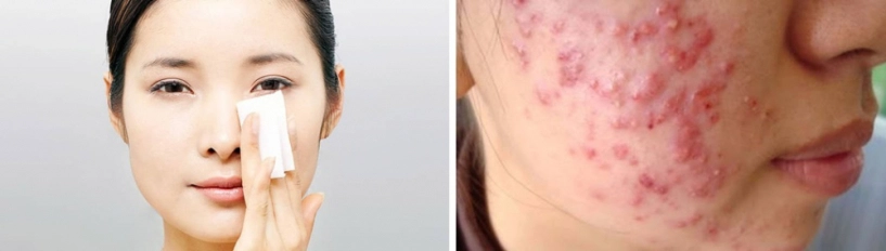 Kính hiển vi bóc trần thành phần của nước vo gạo rửa mặt chị em xem xong phải nghĩ lại - 5