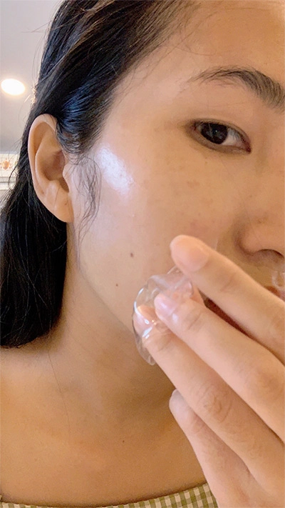 Mặt nạ cho da mụn tại nhà vừa giảm sưng viêm vừa mờ thâm - 4