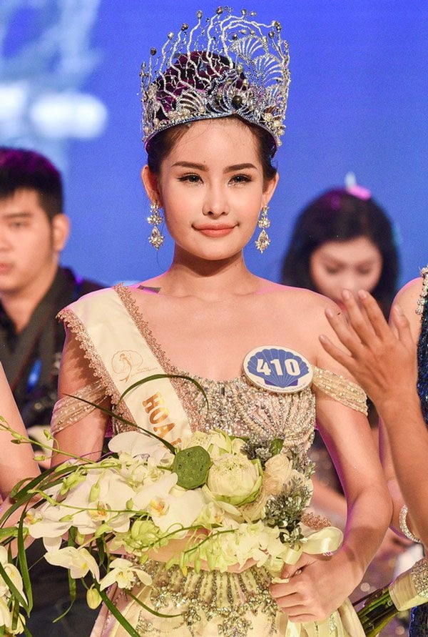 Nhan sắc hiện tại của nàng hậu từng bị đòi vương miện vì đôi môi tều vểnh ngược - 1