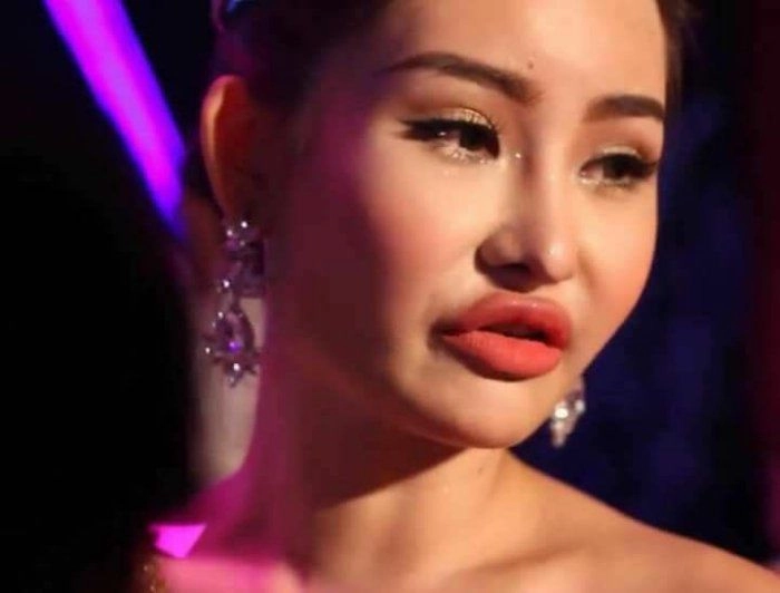 Nhan sắc hiện tại của nàng hậu từng bị đòi vương miện vì đôi môi tều vểnh ngược - 2