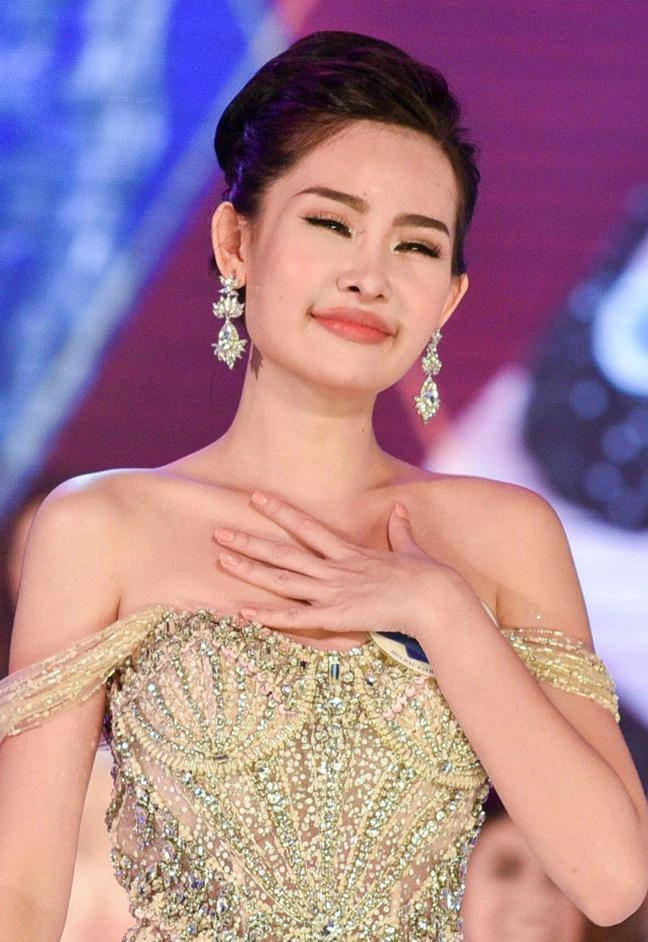 Nhan sắc hiện tại của nàng hậu từng bị đòi vương miện vì đôi môi tều vểnh ngược - 3