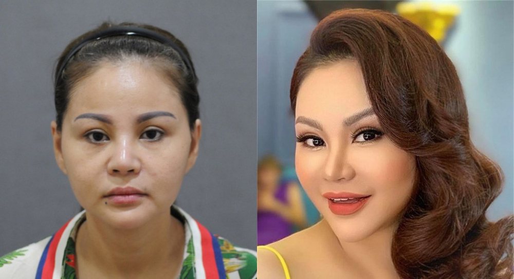 Phẫu thuật thẩm mỹ dày đặc hương giang tụt dốc sức khỏe lê giang khác lạ vẫn chưa muốn dừng - 15