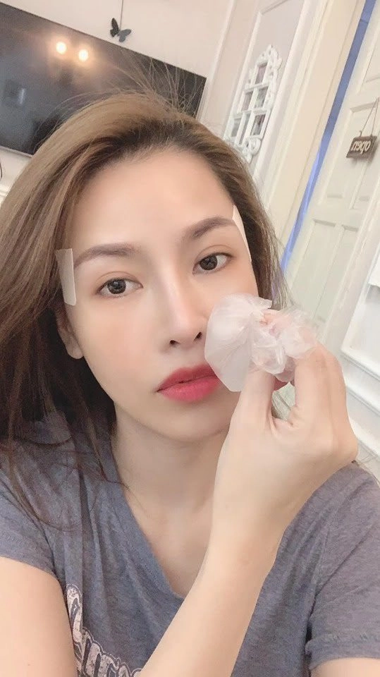Quế vân đập mặt làm lại sở hữu số lần dao kéo kỷ lục vẫn chưa hài lòng - 4
