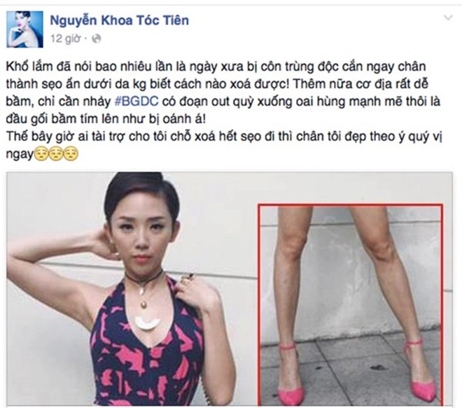 Riêng gì thủy tiên bị ghẻ vì ngâm nước hoa hậu đẹp như hương giang cũng có chân hoa gấm - 5