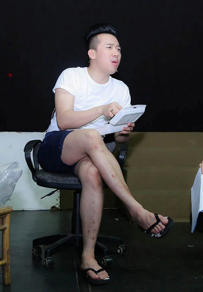 Riêng gì thủy tiên bị ghẻ vì ngâm nước hoa hậu đẹp như hương giang cũng có chân hoa gấm - 9