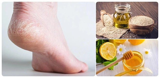 Riêng gì thủy tiên bị ghẻ vì ngâm nước hoa hậu đẹp như hương giang cũng có chân hoa gấm - 10