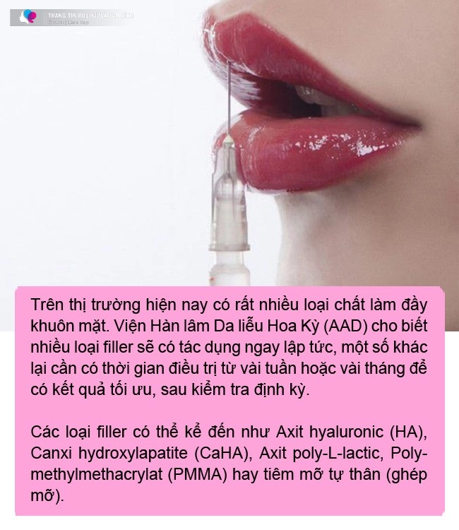 Cuối năm chị em đổ xô tiêm chất làm đầy tăng đột biến chuyên gia nhắn nhủ một điều - 4