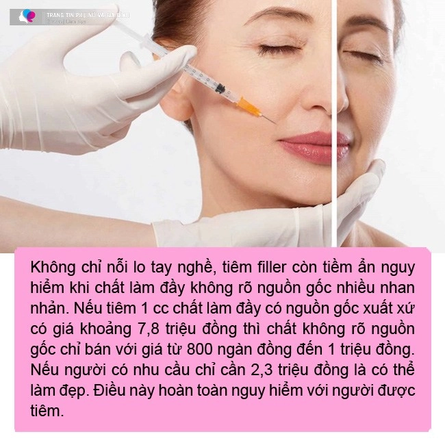 Cuối năm chị em đổ xô tiêm chất làm đầy tăng đột biến chuyên gia nhắn nhủ một điều - 5