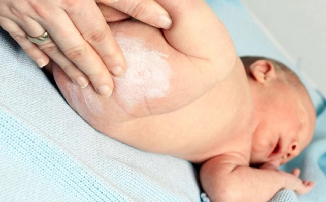 Kem chống hăm cho trẻ sơ sinh và cách dùng hiệu quả - 1