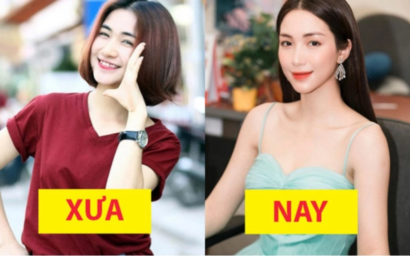 Rộ tin hoà minzy dao kéo gương mặt với góc nghiêng thần thánh chính chủ lên tiếng - 2