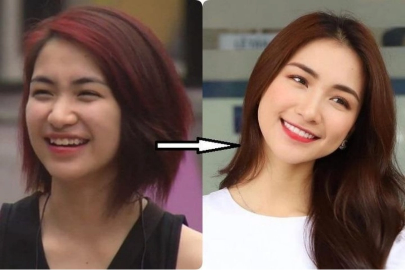 Rộ tin hoà minzy dao kéo gương mặt với góc nghiêng thần thánh chính chủ lên tiếng - 3