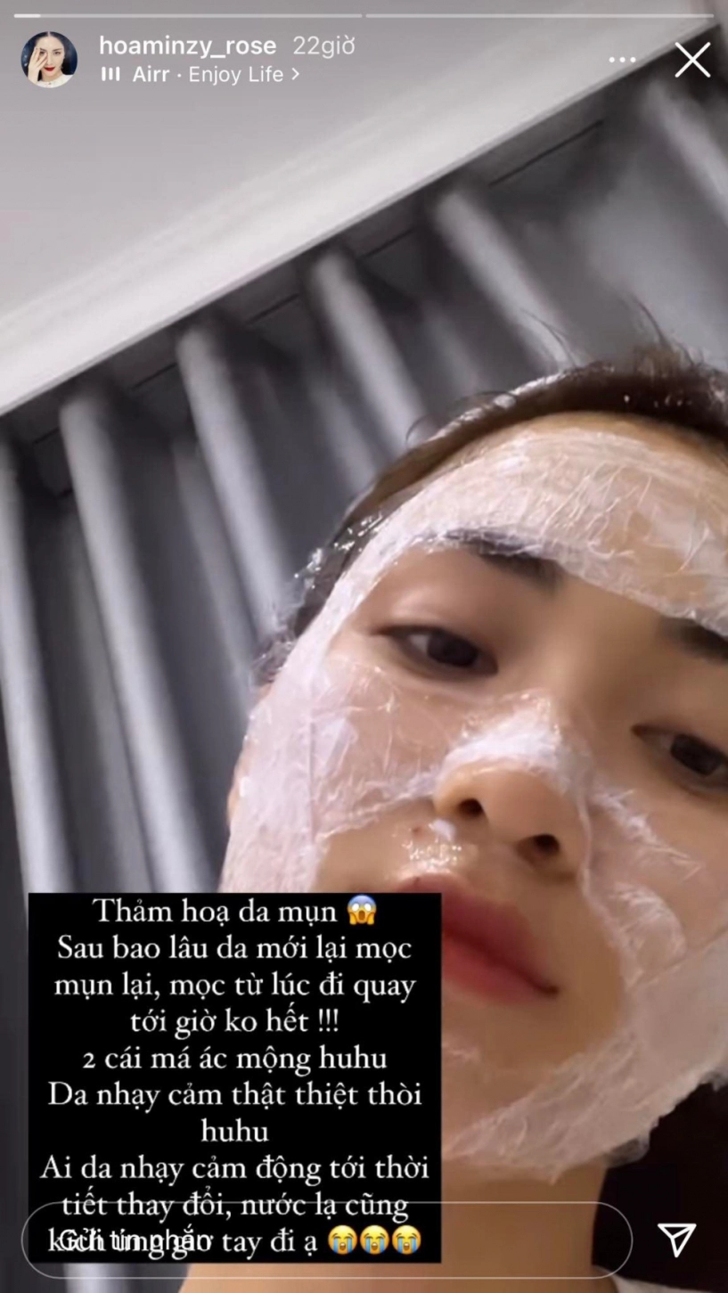 Rộ tin hoà minzy dao kéo gương mặt với góc nghiêng thần thánh chính chủ lên tiếng - 8