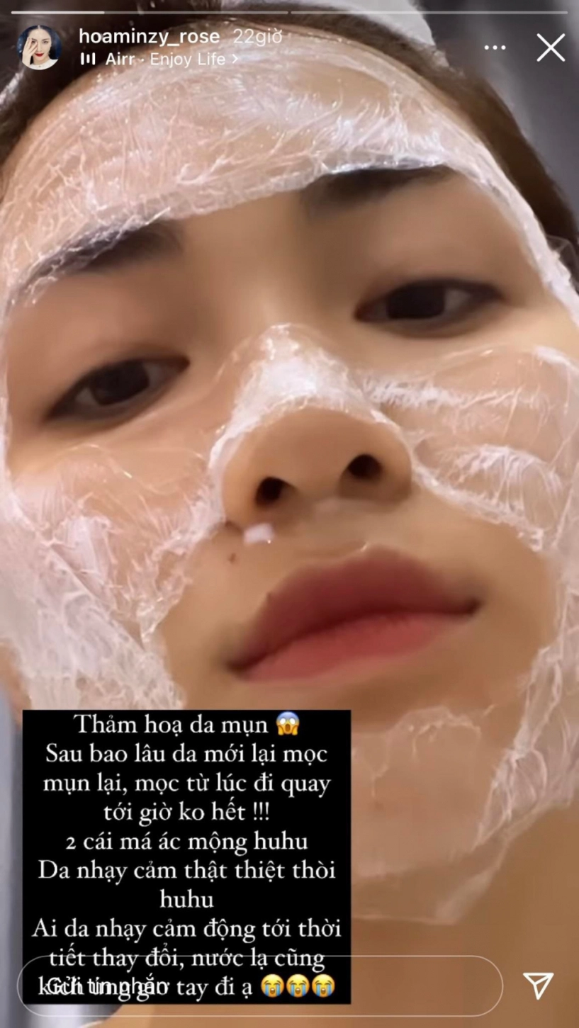 Rộ tin hoà minzy dao kéo gương mặt với góc nghiêng thần thánh chính chủ lên tiếng - 9