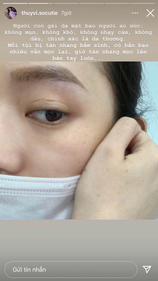 Tưởng có mặt hoa da phấn thuý vi tự bóc khuyết điểm làn da già trước tuổi - 4