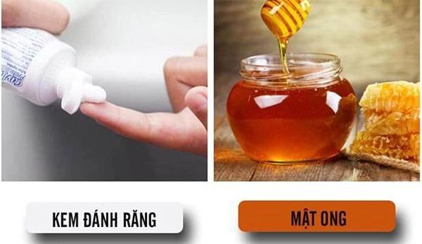 10 cách trị mụn bằng mật ong an toàn hiệu quả nhất tại nhà - 4