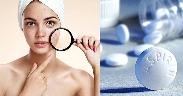 10 cách trị mụn viêm sưng đỏ tại nhà an toàn hiệu quả - 4