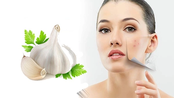 10 cách trị mụn viêm sưng đỏ tại nhà an toàn hiệu quả - 7
