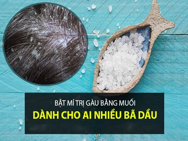 12 cách trị gàu tại nhà dứt điểm hiệu quả nhất từ nguyên liệu tự nhiên - 1