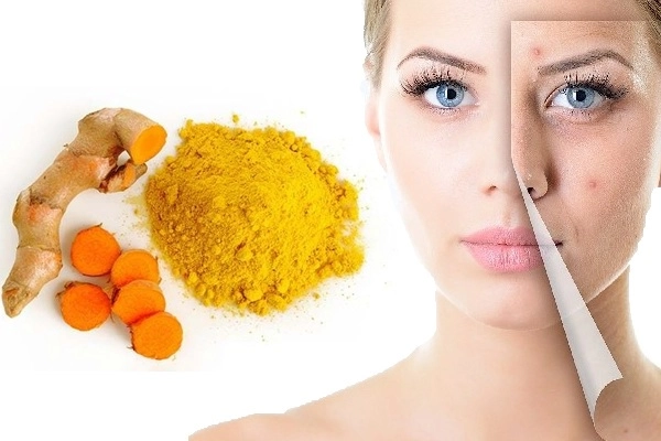 12 cách trị mụn thâm đơn giản an toàn hiệu quả nhanh nhất tại nhà - 1