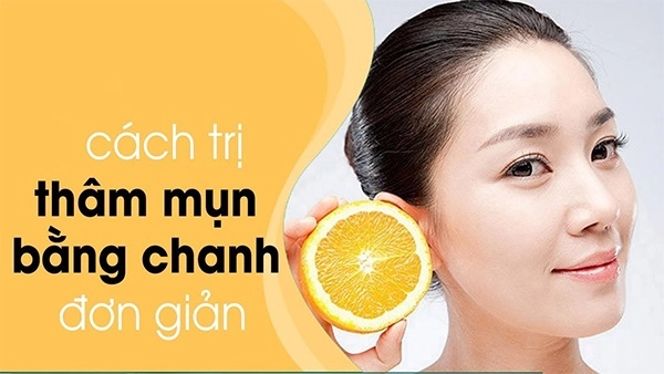 12 cách trị mụn thâm đơn giản an toàn hiệu quả nhanh nhất tại nhà - 4