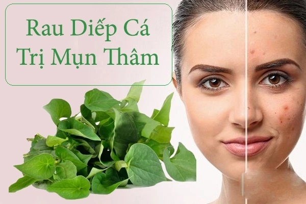 12 cách trị mụn thâm đơn giản an toàn hiệu quả nhanh nhất tại nhà - 6