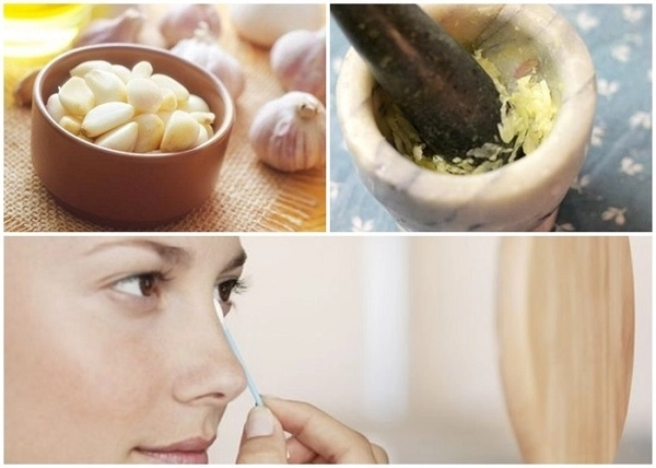12 cách trị mụn thâm đơn giản an toàn hiệu quả nhanh nhất tại nhà - 9