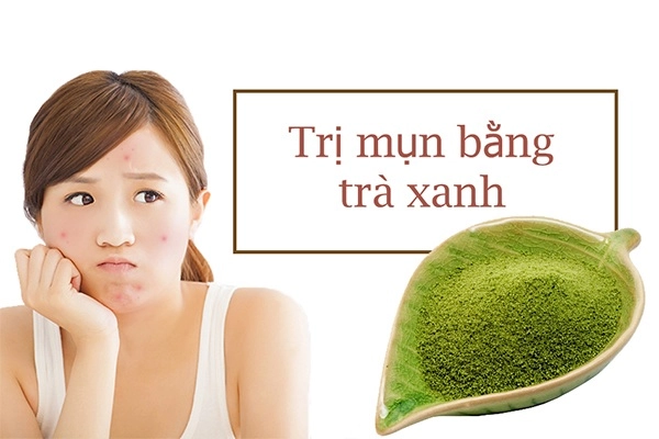 12 cách trị mụn thâm đơn giản an toàn hiệu quả nhanh nhất tại nhà - 11
