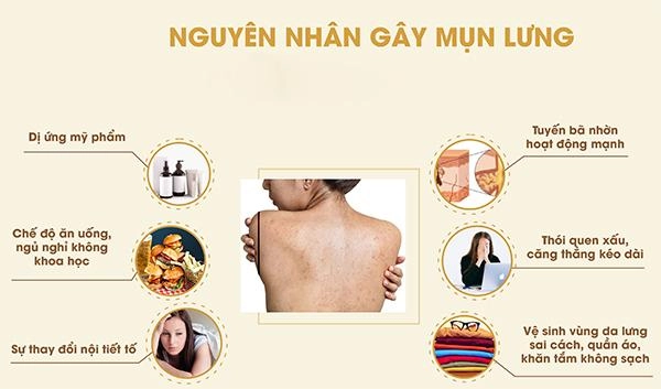 13 cách trị mụn lưng từ nguyên liệu tự nhiên an toàn và hiệu quả nhất - 1