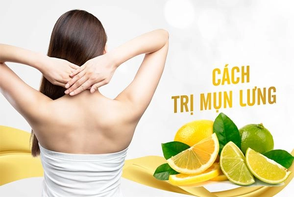 13 cách trị mụn lưng từ nguyên liệu tự nhiên an toàn và hiệu quả nhất - 3