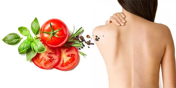 13 cách trị mụn lưng từ nguyên liệu tự nhiên an toàn và hiệu quả nhất - 7